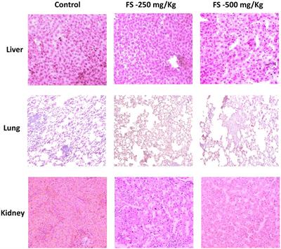 Sub-acute Toxicity Assessment of Taxol Isolated From Fusarium Solani, an Endophytic Fungus of Taxus Brevifolia, in Wistar Rats and Analyzing Its Cytotoxicity and Apoptotic Potential in Lung Cancer Cells